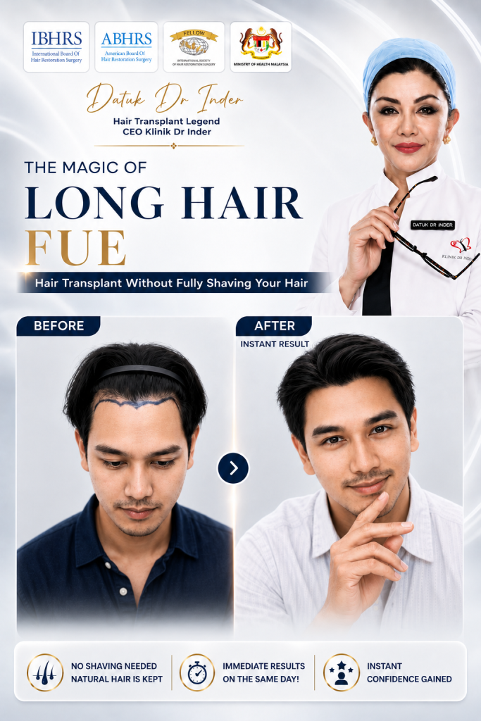 igraft long hair fue - hero section image
