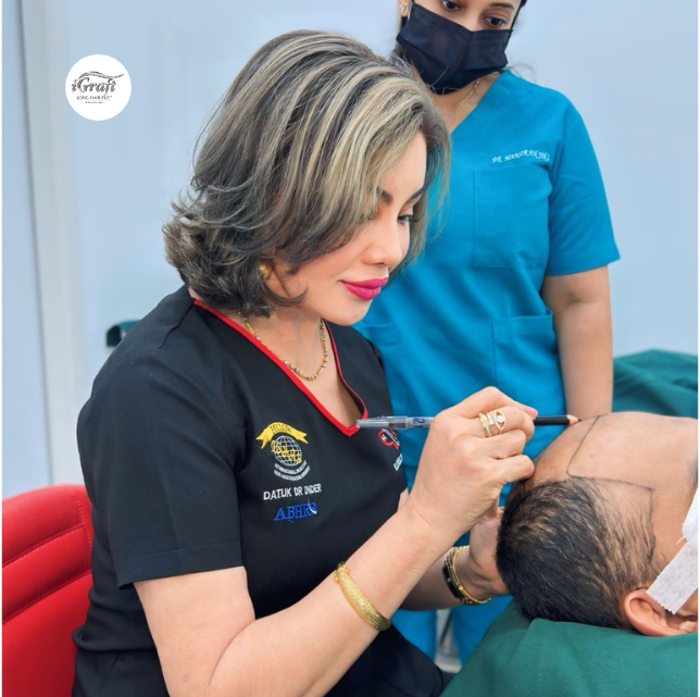 Datuk Dr Inder - Drawing Hairline