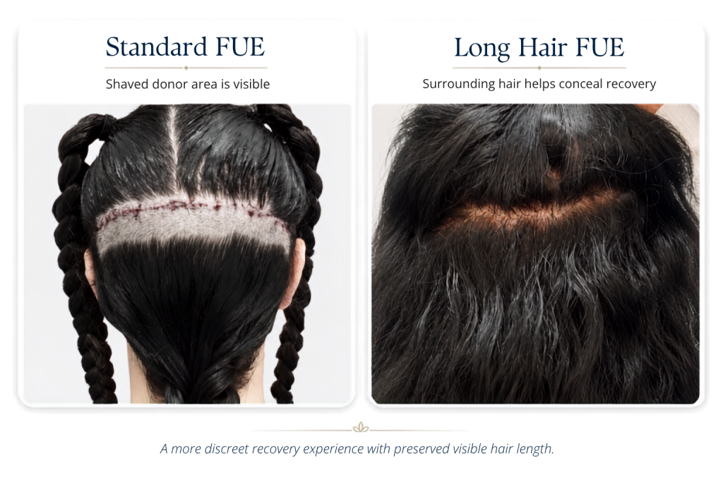 Long Hair FUE vs. standard FUE - Donor Area