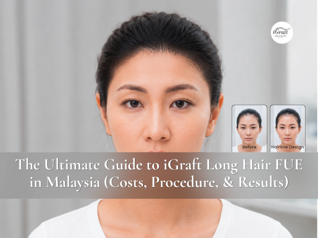 The Ultimate Guide to iGraft Long Hair FUE Malaysia (Costs, Procedure, & Results)