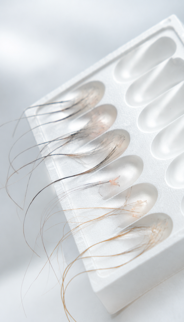 Why Long Hair FUE is more technically demanding.