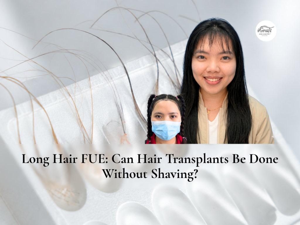 Long Hair FUE_ Can Hair Transplants Be Done Without Shaving