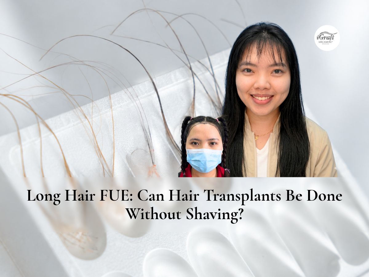 Long Hair FUE_ Can Hair Transplants Be Done Without Shaving